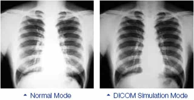 DICOM Medical Simulation X-ray image